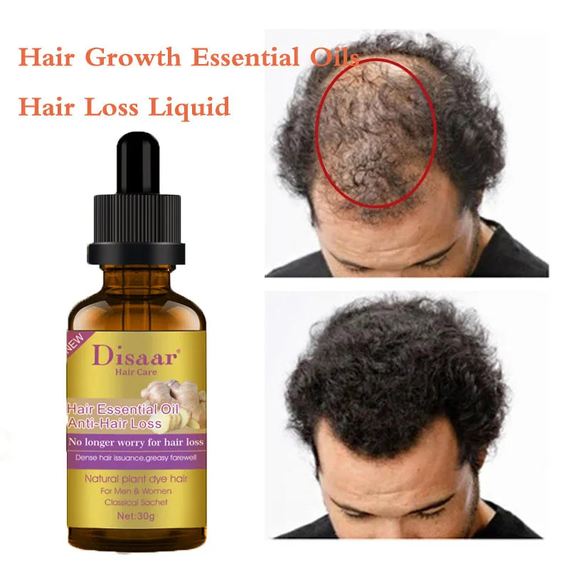 DISAAR Huile Capillaire  Essence de Gingembre