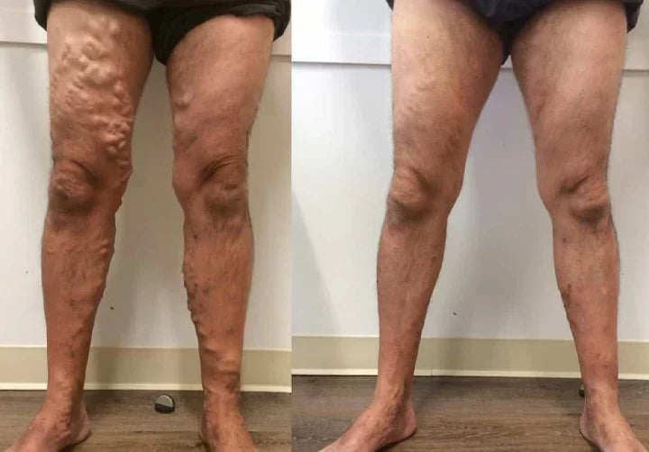 Soulagez Les Douleurs, Améliorez La circulation Et Rendez Votre Peau Douce Avec South Moon