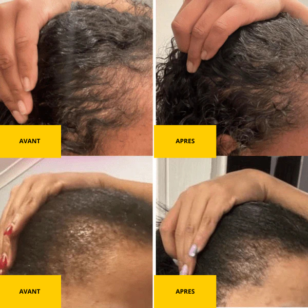 Faites Pousser Vos Cheveux 4 Fois Plus Vite