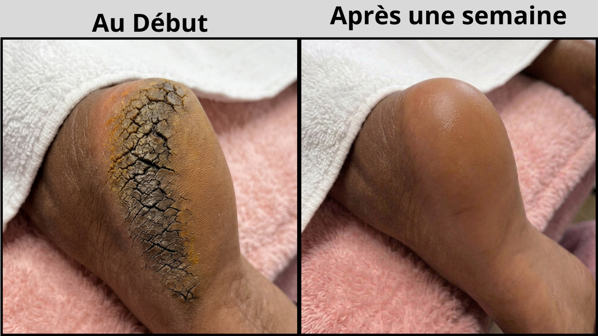 Baume Miracle Réparateur Pieds et Mains