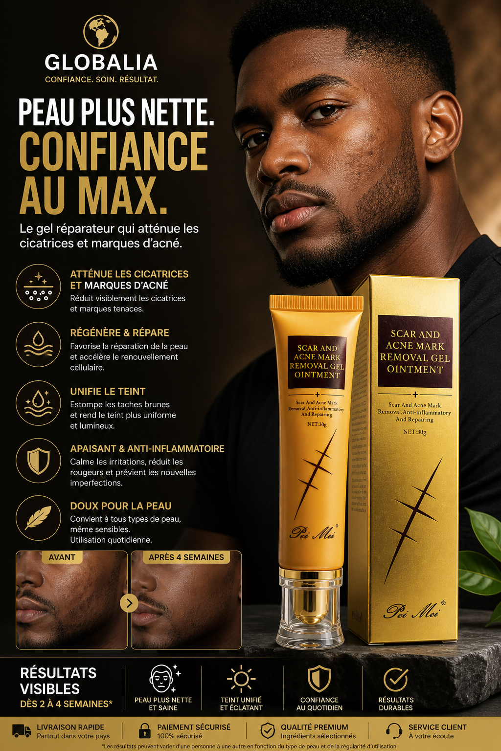 Gel Anti Cicatrices & Marques d’Acné Pei Mei – Peau Lisse & Réparée