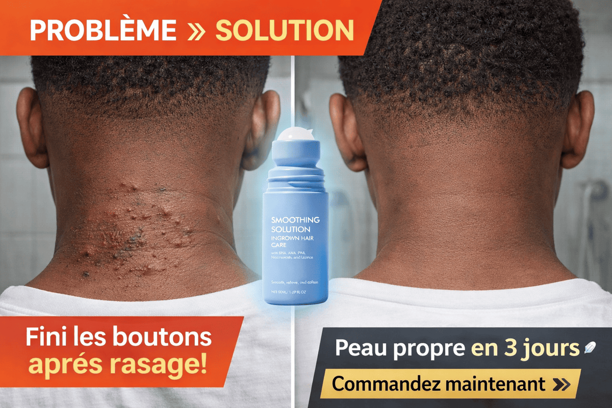 🍶Crème Anti-Boutons Après Rasage — SoftSkin 💆‍♂️