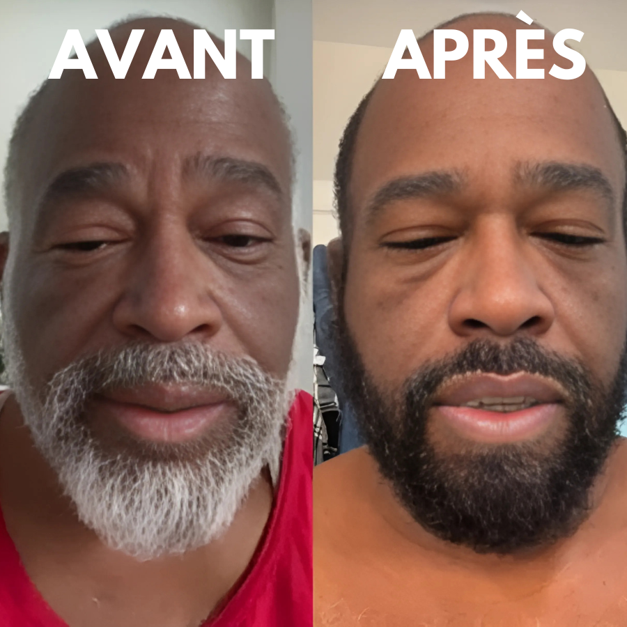 AKTALO - Dites Adieu aux cheveux blancs EN 8 MINUTES ! Garantie Satisfait ou remboursé