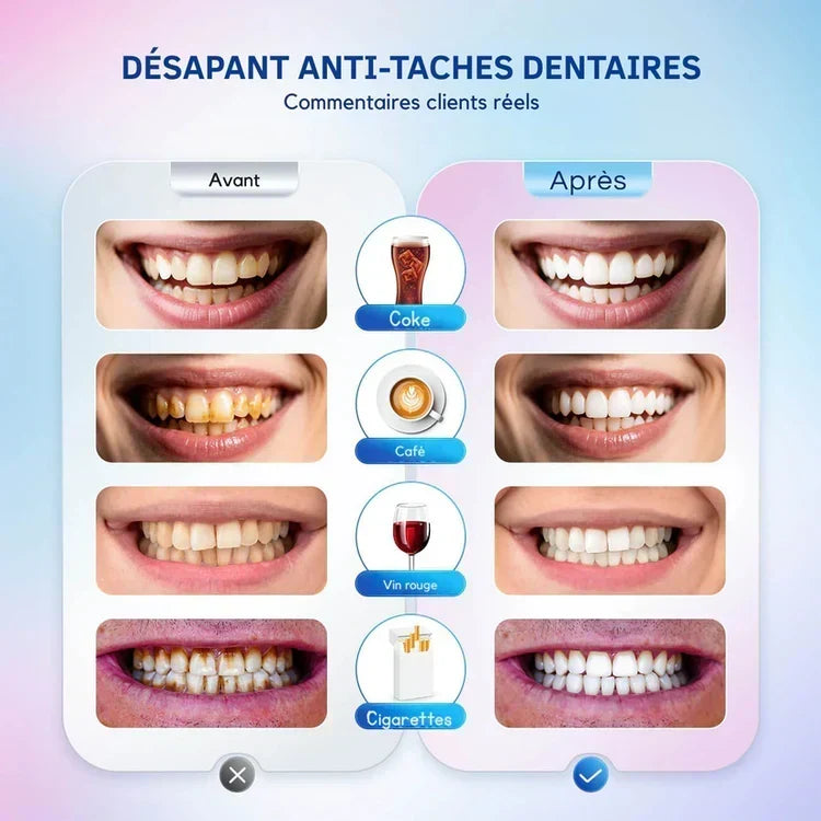 Dentifrice Blanchissant à la Niacinamide – Sourire Éclatant & Blancheur Visible Dès Les Premières Utilisations ✨🦷