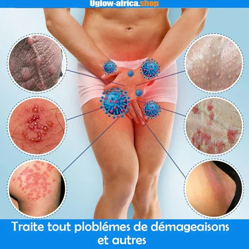 Crème anti-démangeaisons & Antibactérienne cmr
