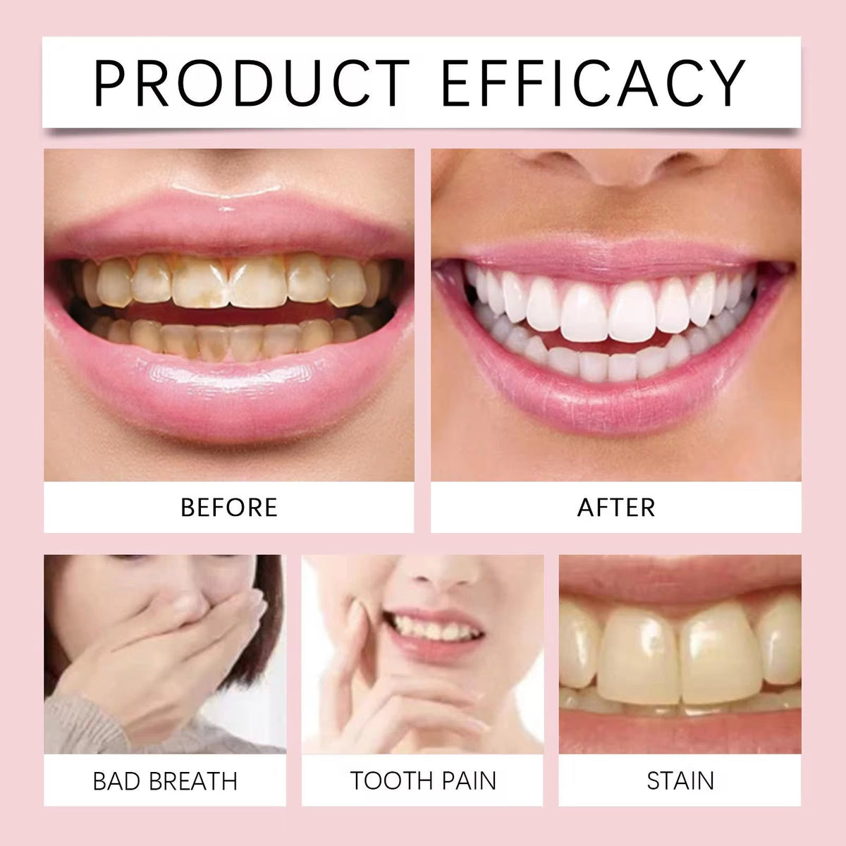 DENTIFRICE BLANCHISSANT SP-6