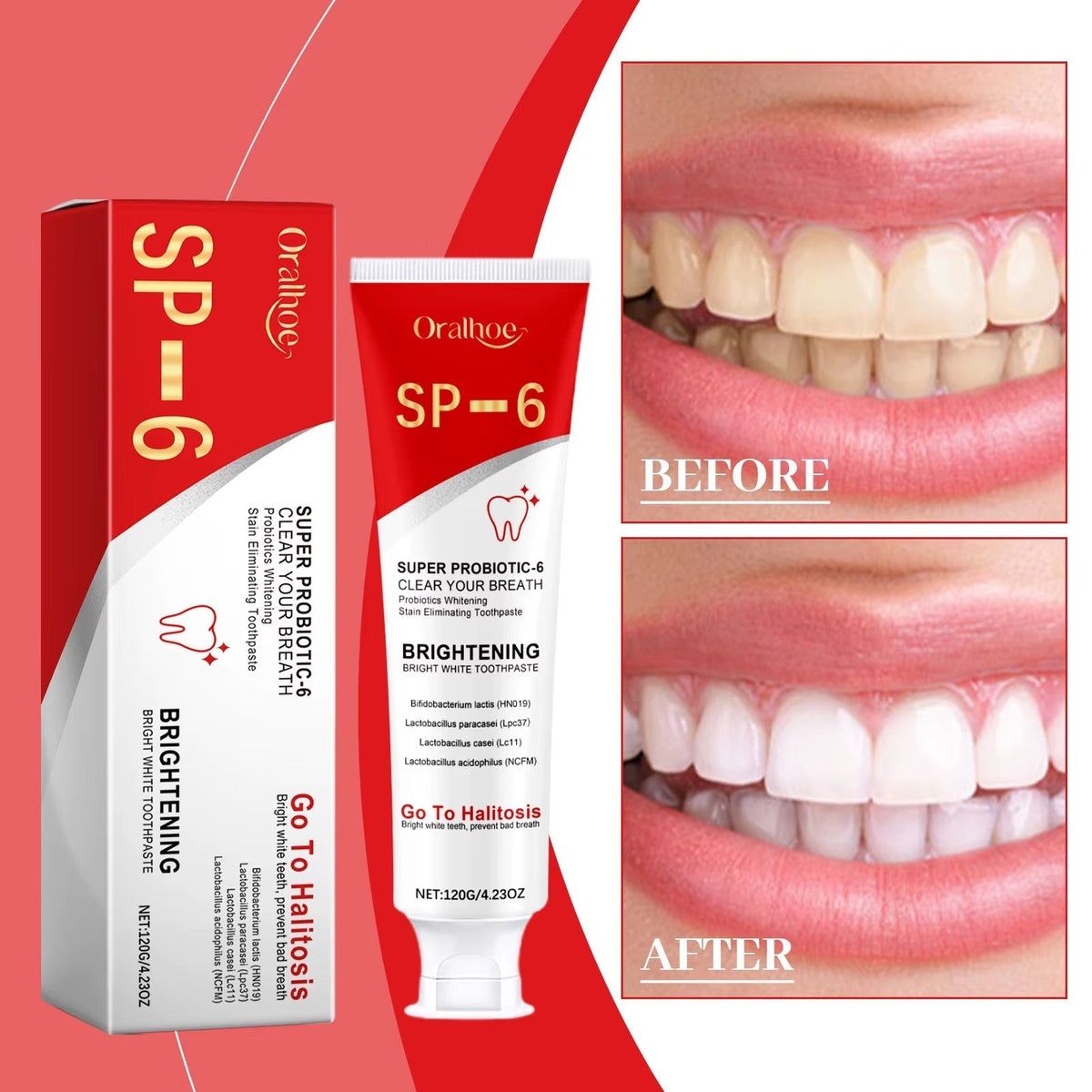 DENTIFRICE BLANCHISSANT SP-6