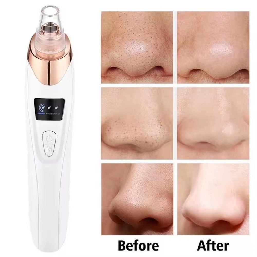 Comédon électrique, Appareil de soin du visage anti points noirs