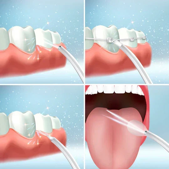 Irrigateur buccal – vue 4