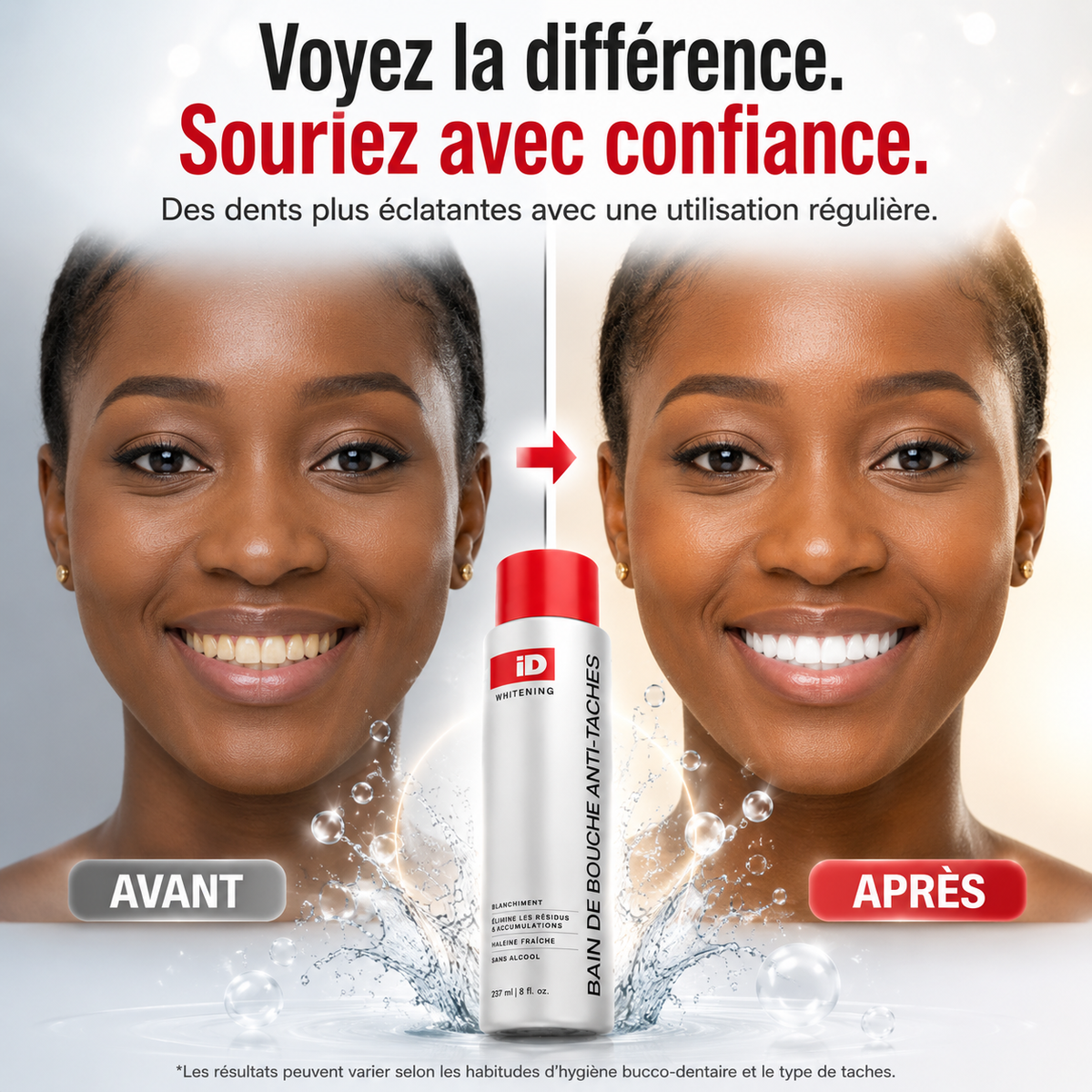 Bain de bouche – vue 5