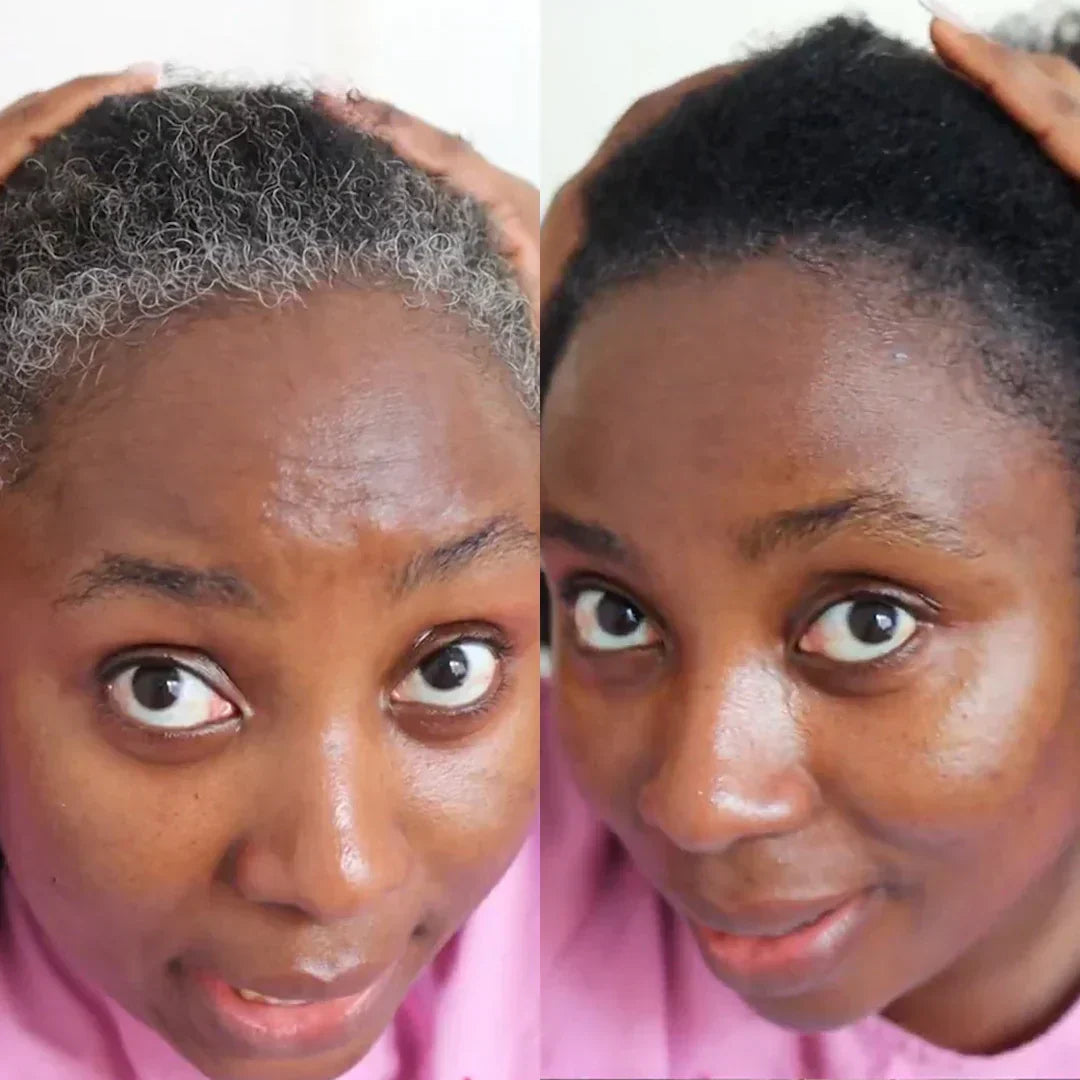 AKTALO - 🇨🇮 Dites Adieu aux cheveux blancs EN 8 MINUTES ! Garantie Satisfait ou remboursé