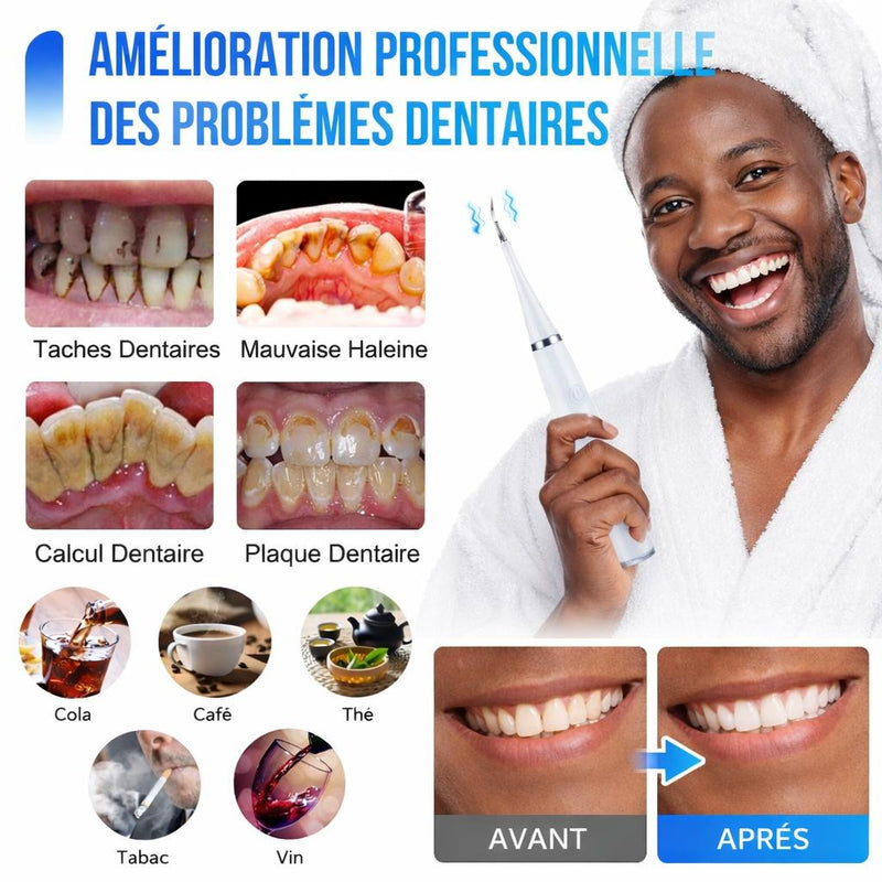 KIT DE BLANCHIMENT DENTAIRE A DOMICILE