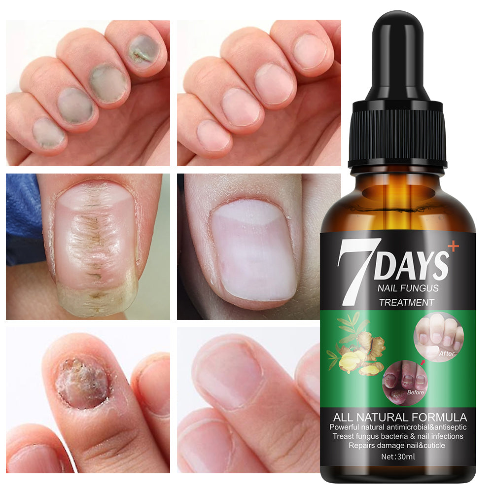 Retrouvez des Ongles Propres Naturellement