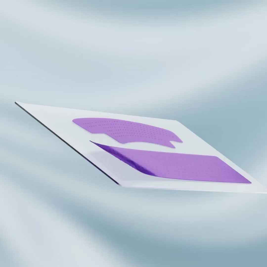 Sourire après application du V34
